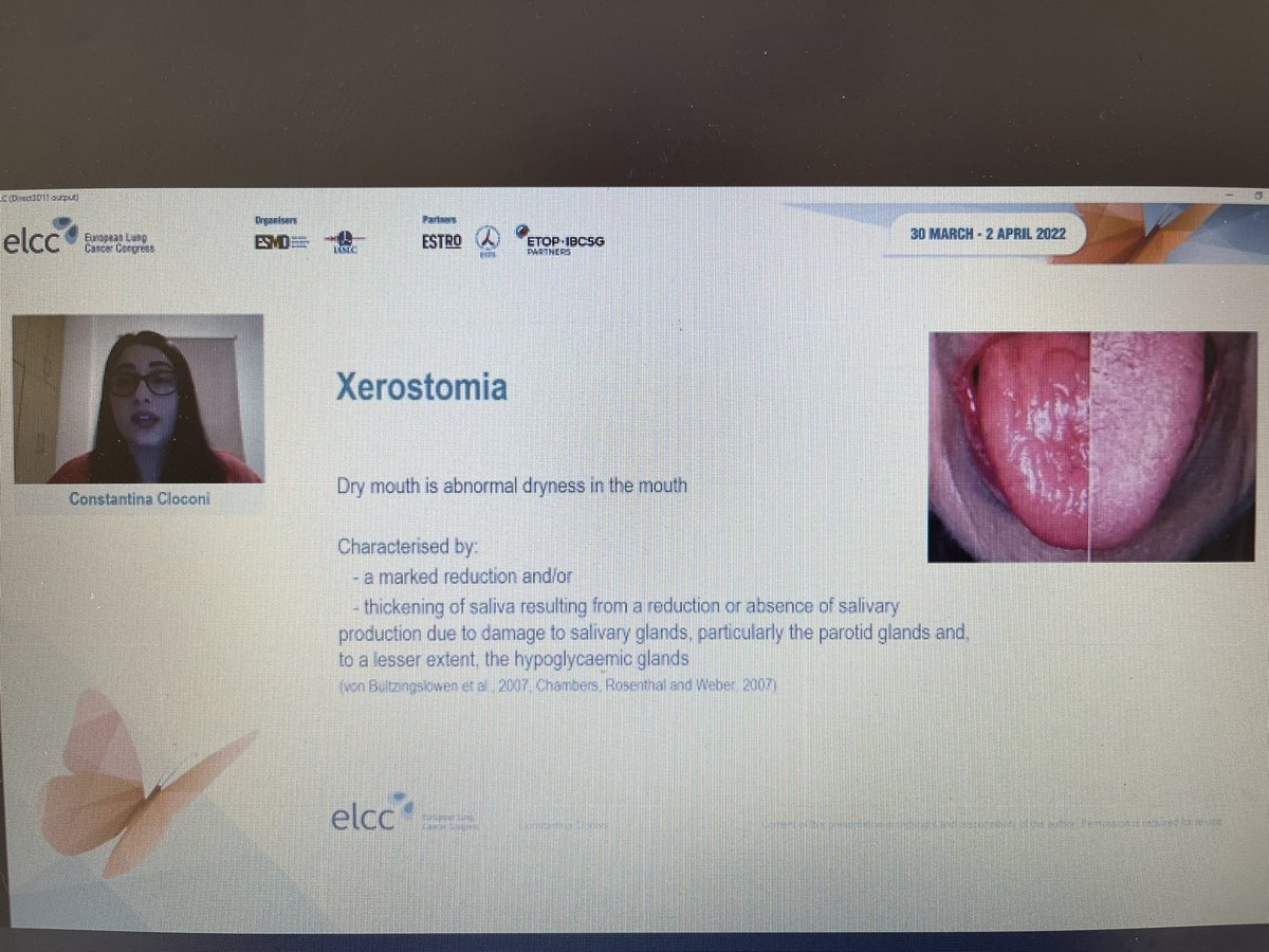 Andreas Charalambous (@andreasc466) on Twitter photo <a href="/ConstantinaCloc/">Constantina Cloconi</a> presenting on the oral toxicities in the lung cancer context and the debilating effect they have on patients. <a href="/QuistMorten/">Morten Quist</a> <a href="/myESMO/">ESMO - Eur. Oncology</a> <a href="/cancernurseEU/">@cancernurseEU</a> <a href="/OncoAlert/">OncoAlert</a> <a href="/ConstantinaCloc/">Constantina Cloconi</a> presenting on the oral toxicities in the lung cancer context and the debilating effect they have on patients. <a href="/QuistMorten/">Morten Quist</a> <a href="/myESMO/">ESMO - Eur. Oncology</a> <a href="/cancernurseEU/">@cancernurseEU</a> <a href="/OncoAlert/">OncoAlert</a>