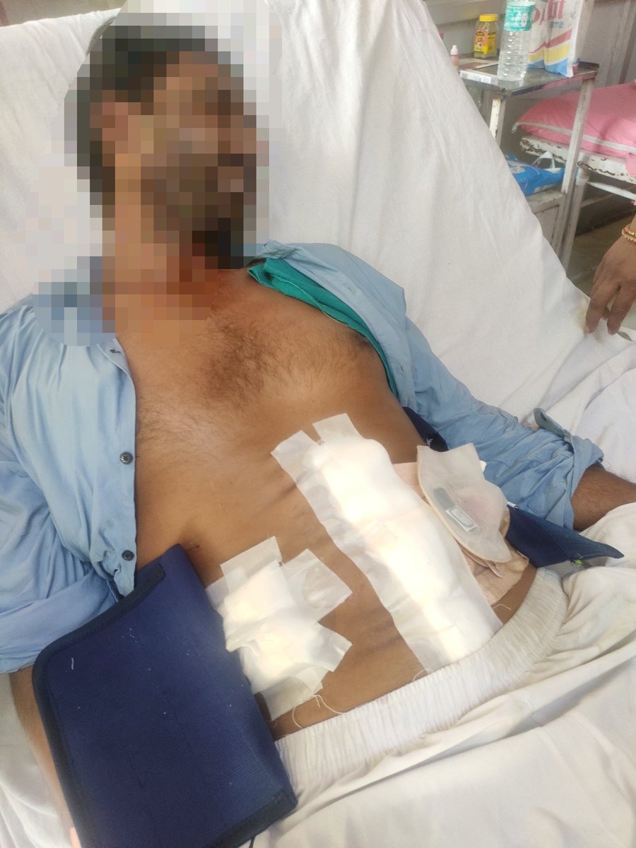 Amit Lakhani (@theamitlakhani) on Twitter photo Such a ghastly incident from Rohtak in Haryana & no arrest by <a href="/RohtakPolice/">Rohtak Police</a> , no coverage by national media.
Wife along with her relatives inserted a rod laced with red chilli powder inside the anus of this man who's battling for life in the hospital.
<a href="/cmohry/">CMO Haryana</a> must intervene. Such a ghastly incident from Rohtak in Haryana & no arrest by <a href="/RohtakPolice/">Rohtak Police</a> , no coverage by national media.
Wife along with her relatives inserted a rod laced with red chilli powder inside the anus of this man who's battling for life in the hospital.
<a href="/cmohry/">CMO Haryana</a> must intervene.