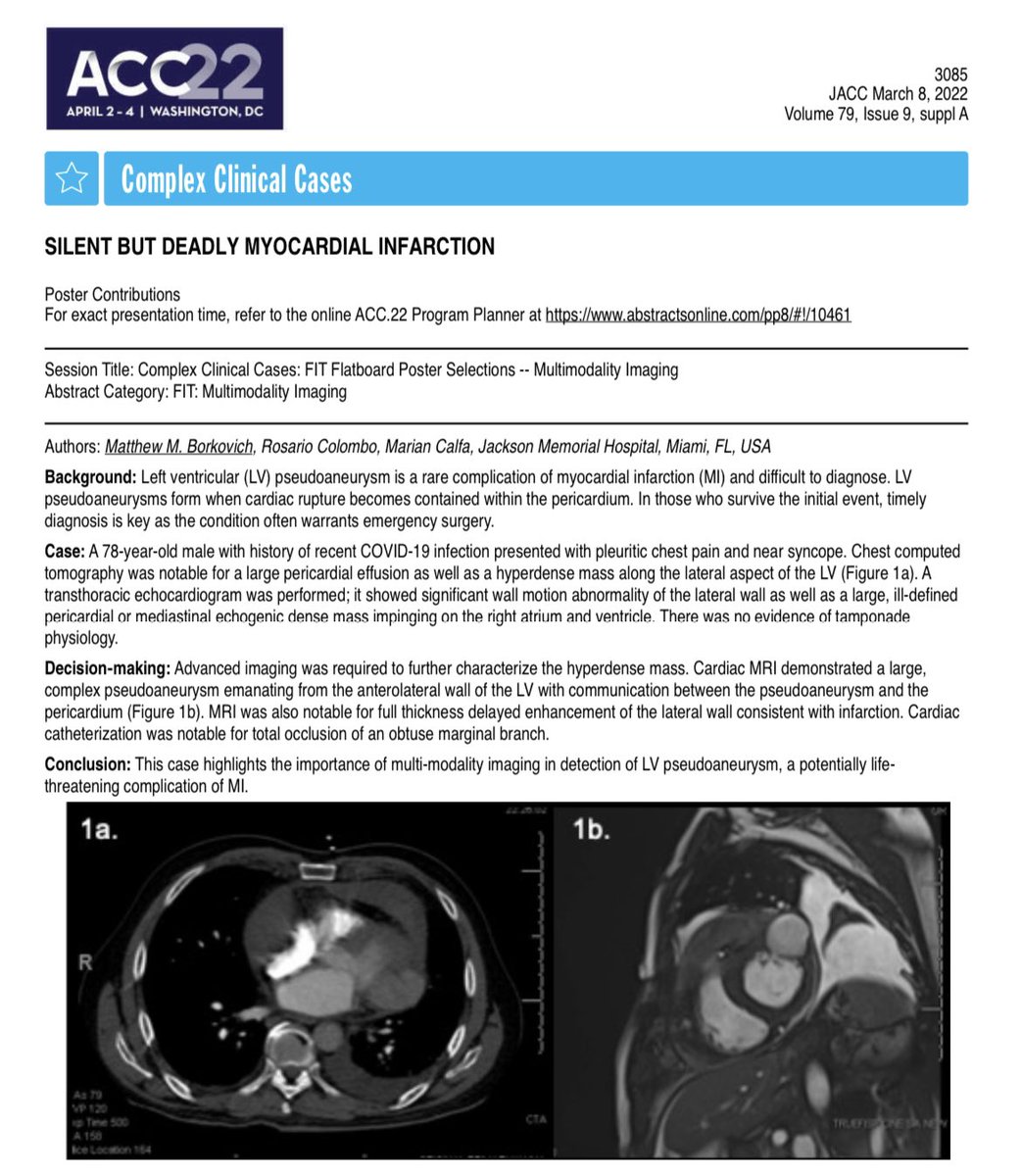 Rosario “Russ” Colombo, MD, FACC (@russcolombomd) on Twitter photo Proud of my mentees presenting abstracts this year at #ACC22! IM Residents <a href="/NParelladaMD/">Nicole Parellada MD</a> <a href="/vhurtadomd/">Vanessa Hurtado, MD</a> <a href="/SukhpreetKaur_1/">Sukhpreet Kaur</a> <a href="/KarlaLInestroz1/">Karla Inestroza Andino</a> & CV fellows Drs. Matthew Borkovich, George Leonor Lopez along with my colleague Dr. Marian Calfa <a href="/JacksonHealth/">Jackson Health System</a> <a href="/UMJMHCardiology/">UMCardiology Fellows</a> <a href="/UmJmhIMRes/">University of Miami Internal Medicine Residency</a> Proud of my mentees presenting abstracts this year at #ACC22! IM Residents <a href="/NParelladaMD/">Nicole Parellada MD</a> <a href="/vhurtadomd/">Vanessa Hurtado, MD</a> <a href="/SukhpreetKaur_1/">Sukhpreet Kaur</a> <a href="/KarlaLInestroz1/">Karla Inestroza Andino</a> & CV fellows Drs. Matthew Borkovich, George Leonor Lopez along with my colleague Dr. Marian Calfa <a href="/JacksonHealth/">Jackson Health System</a> <a href="/UMJMHCardiology/">UMCardiology Fellows</a> <a href="/UmJmhIMRes/">University of Miami Internal Medicine Residency</a>