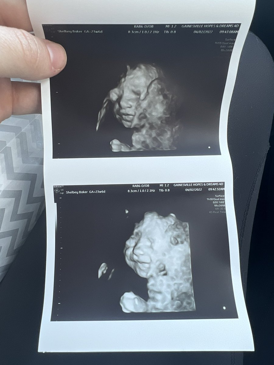ssshelbybaker's tweet photo. we are going to have such a beautiful baby girl 😭 https://t.co/OHx5ODCRZn