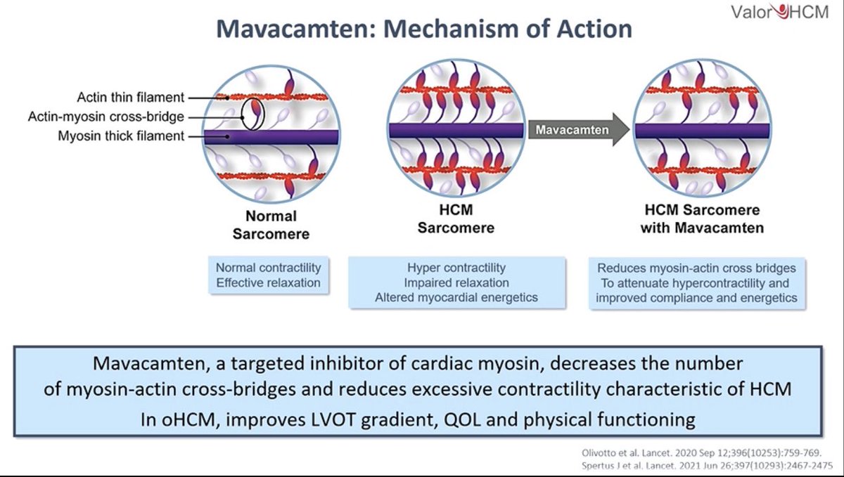 GiuseppeGalati_'s tweet photo. 🔥#VALOR_HCM
Important results for #Mavacamtem vs Placebo in #HOCM ⬇️ the need of
🔪 Septal miectomy
🍷 Septal Ablation
@radcliffeCARDIO
#ACCRME #ACC22
@DrMarthaGulati @IacopoOlivotto @AlessiaArgiro @SilCastelletti @CSHeartResearch @MicheleSenni @KTamirisaMD @gbiondizoccai https://t.co/LCQ7Pmnt5c