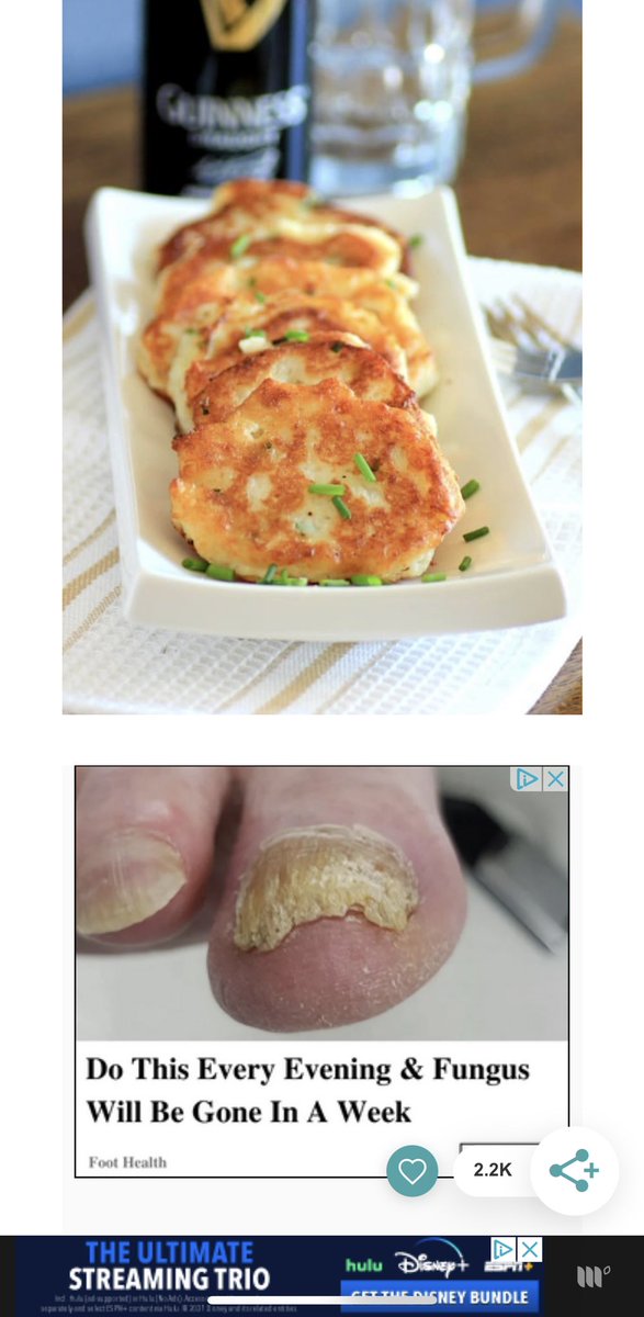 mactosix's tweet photo. This is why people use ad-blockers. Why serve toe fungus adds on a recipe website? https://t.co/qsUttn8162