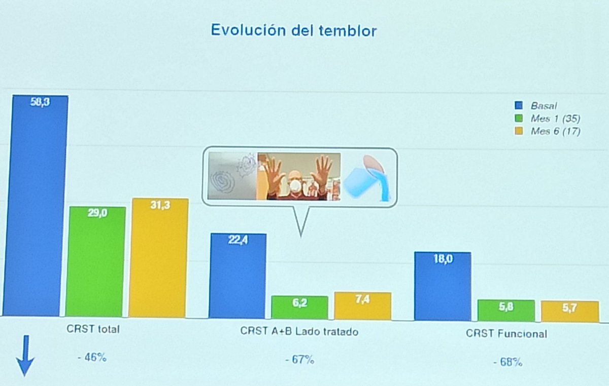OdeFabregues's tweet photo. Aprendiendo de la primera experiencia en #HiFu en un Hospital Público español, y grato contacto físico con colegas expertos en Sonificación Cerebral Terapéutica #GETM #SENFE
#SantiagodeCompostela https://t.co/2qfjtlTY2Q