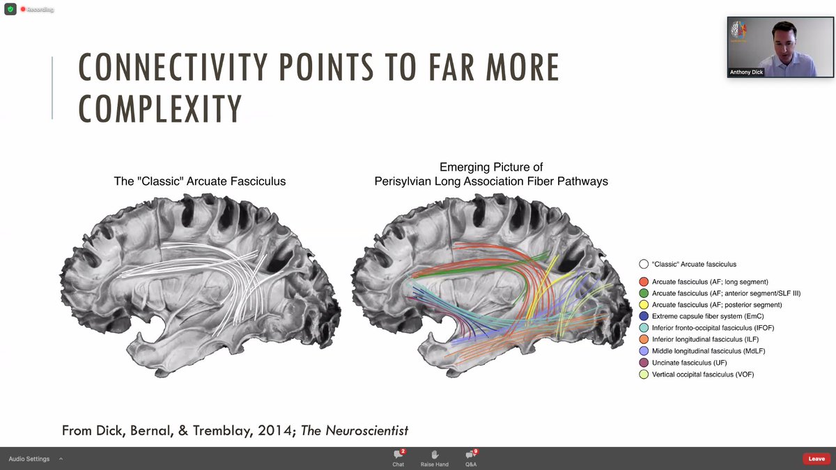 New mapping technologies have been game changers in the development of new cognitive (i.e. language) models  and it is time to overpass the dualistic Broca-Wernicke model of language in academic and clinical environments. Great talk during IamBrain2022.
<a href="/trainthebest/">Masters of Neurosurgery</a>  #language