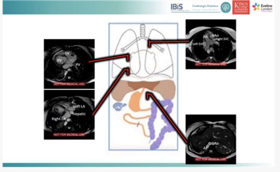 Jennifer Co-Vu, MD, FACC, FAAP, FASE tweet media
