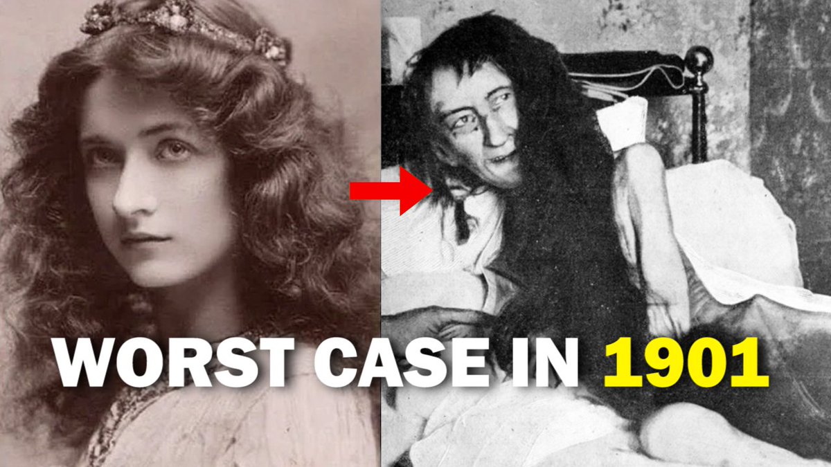 Horror___Phobia's tweet photo. इतिहास की सबसे भयानक घटना | Blanche Monnier | Horror Phobia #BlancheMonnierCase #ElCasoDeBlancheMonnier #Youtube
Video link - https://t.co/QoWLxwGT7r https://t.co/aGSFJYuOAk