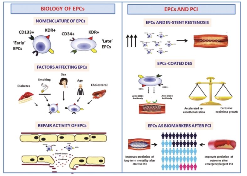 Francesco Pelliccia (@pelliccia_f) on Twitter photo Endothelial Progenitor Cells in Coronary Artery Disease: From Bench to Bedside <a href="/MZimarino/">Marco Zimarino</a> <a href="/pelliccia_f/">Francesco Pelliccia</a> @cardiotwitter <a href="/glimongelli/">Giuseppe Limongelli</a> <a href="/DoryMD/">Doralisa Morrone</a> <a href="/SIC_CARDIOLOGIA/">SIC Società Italiana di Cardiologia</a> <a href="/escardio/">European Society of Cardiology</a> academic.oup.com/stcltm/advance… Endothelial Progenitor Cells in Coronary Artery Disease: From Bench to Bedside <a href="/MZimarino/">Marco Zimarino</a> <a href="/pelliccia_f/">Francesco Pelliccia</a> @cardiotwitter <a href="/glimongelli/">Giuseppe Limongelli</a> <a href="/DoryMD/">Doralisa Morrone</a> <a href="/SIC_CARDIOLOGIA/">SIC Società Italiana di Cardiologia</a> <a href="/escardio/">European Society of Cardiology</a> academic.oup.com/stcltm/advance…