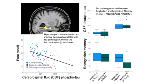 Duzel et al. show that tau pathology correlates with hippocampal dysfunction and memory impairment in individuals with amyloid pathology but not in those without, even if they carry a genetic risk for Alzheimer’s disease. bit.ly/3wZyrhy