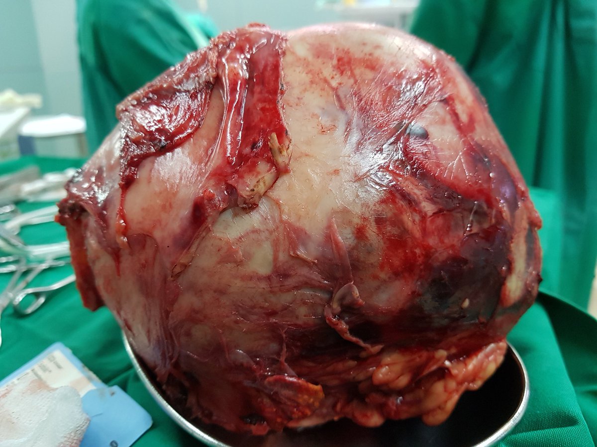 Cerita sedikit tentang tumor ginjal

Bismillaah..
Kemarin saat praktek dan visite d rs sy ketemu 3 o...