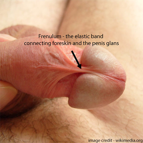 TopSexologist's tweet photo. What is frenulum breve or short frenulum?
Frenulum refers to the elastic skin that exists under the penis connecting the penis head and the foreskin. This is similar to the frenulum under the tongue and the lower jaw in the mouth. 
Read more at https://t.co/pTFb3p8TwK https://t.co/j8HR1yCOiJ