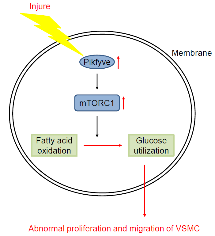 JCVPOnline's tweet photo. Targeting PIKfyve to alleviate vascular neointimal hyperplasia after injury.
https://t.co/LmzLMy8h50
#vascular #restenosis #muscle #mTORC #silencing #phosphorylation #glucose #C57BL #carotid https://t.co/2CGjTzrUaD