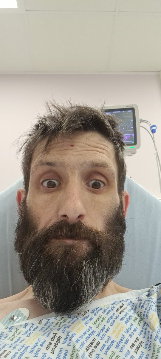 alanopiehall's tweet photo. When painkillers kick in not pupil in site https://t.co/iOH8Bd0AqC