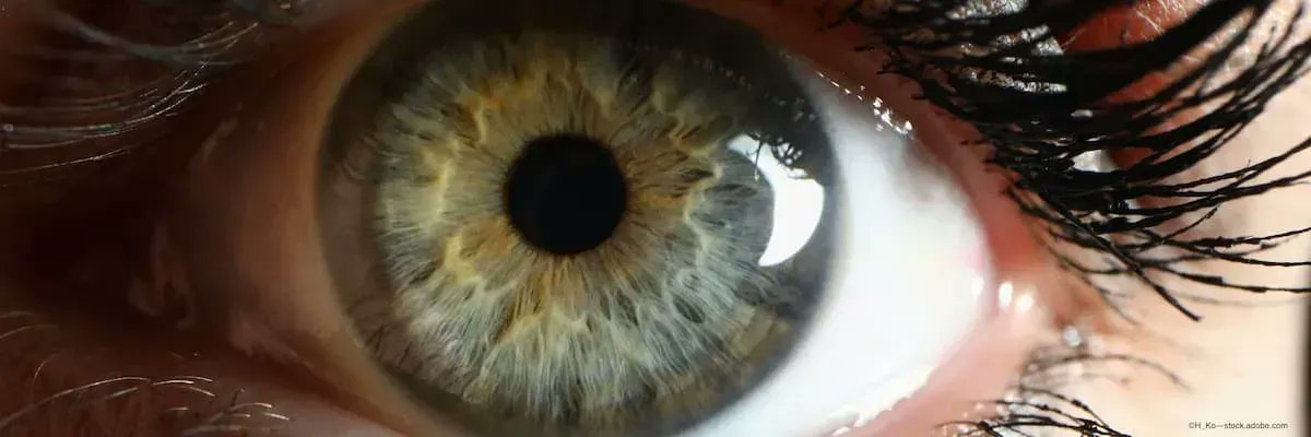 Differences in pupil sizes distinguish between active and resolved COVID-19 cases #Ophthalmology #COVID19 buff.ly/35ctm9z