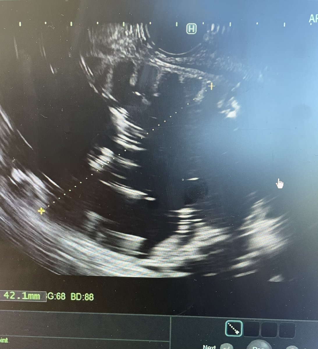 Amaninder Dhaliwal tweet media