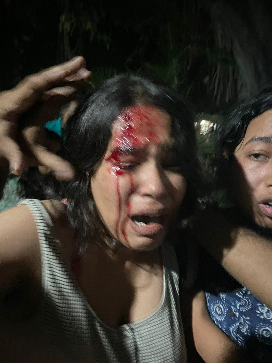 ShankarKumar_'s tweet photo. #JNU छात्रों पर एक बार फिर #ABVP गुंडों का जानलेवा हमला।
#ABVP गुंडों ने नॉन वेज खाने को लेकर कावेरी हॉस्टल के मेस सचिव और छात्रों पर जानलेवा हमला किया।
इस देश में अब कौन क्या खायेगा, क्या पहनेगा, किससे शादी करेगा ये सब अब इस देश में ये गुंडे तय करेंगे।
#SOSJNU #ABVPTerrorist https://t.co/REuoMRxTiF