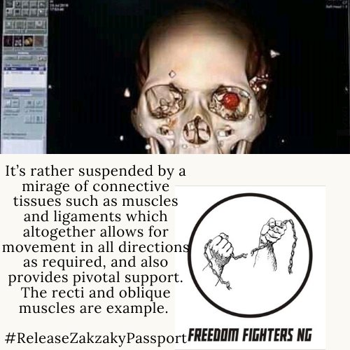 alil_hadi's tweet photo. It’s rather suspended by a mirage of connective tissues such as muscles &amp; ligaments which altogether allows for movement in all directions as required, and also provides pivotal support. D recti and oblique muscles r example. 

#ReleaseZakzakyPassport 
https://t.co/o6H0GrW2rI https://t.co/iw8Vna8wR5