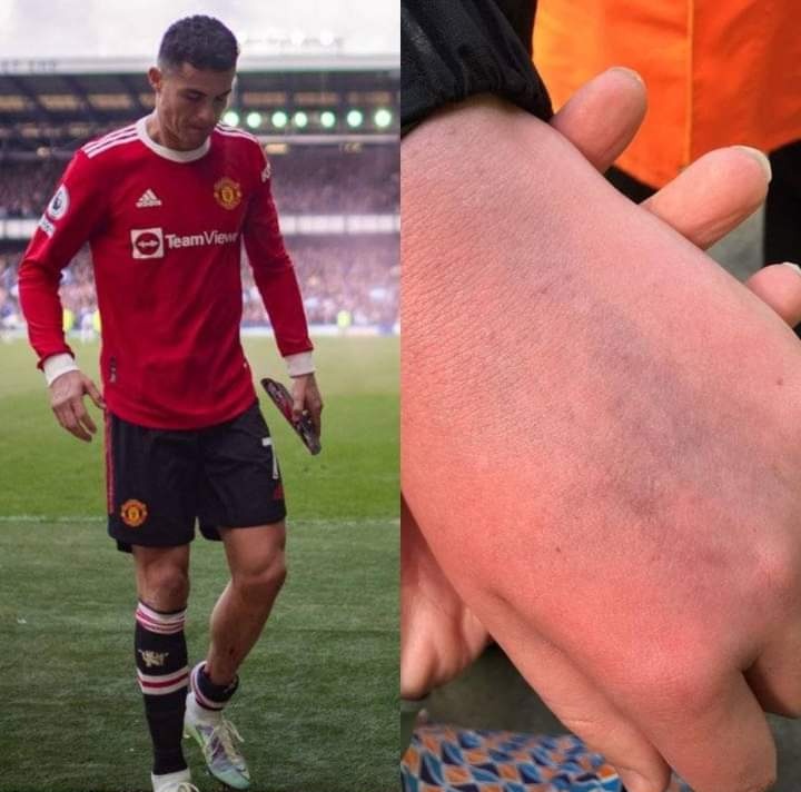 sami_amaro's tweet photo. independente da rivalidade, oq o cr7 fez não tem passada de pano, ele agrediu uma CRIANÇA, autista, inocente, é NOJENTO... o cara tem 37 anos, a maturidade ficou onde????? 
não digo que devem deixar de gostar dele, mas reconheçam que ele ERROU, e não passem pano pra isso https://t.co/WOfyxprVTa