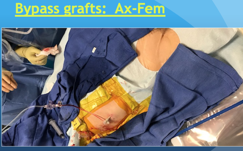 HadyLichaaMD's tweet photo. Risk/Benefit ratio varies in #AlternativeAccess
@andresvargasECU @surgmax @rahilraf @DrSethdb @AdityaMandawat @dchite1 @mobitz @jamiemccabeMD @SDhandMD @RealDrAntonious @BGalperMD @ElhayekMD @GBarnesMD @herbaronowMD @karrowni @A_N_Mahmoud_MD @ATYounesMD @DougDrachmanMD https://t.co/r9251NX0h3