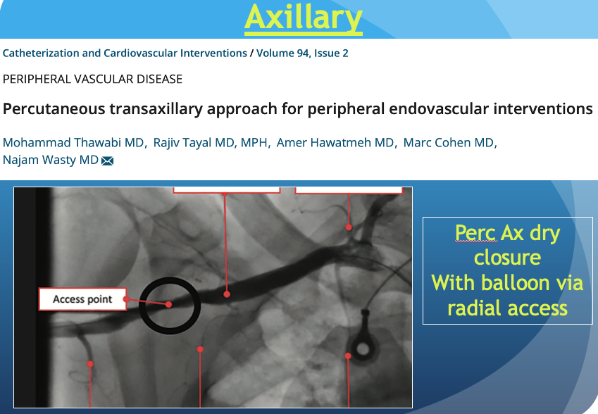 HadyLichaaMD's tweet photo. Risk/Benefit ratio varies in #AlternativeAccess
@andresvargasECU @surgmax @rahilraf @DrSethdb @AdityaMandawat @dchite1 @mobitz @jamiemccabeMD @SDhandMD @RealDrAntonious @BGalperMD @ElhayekMD @GBarnesMD @herbaronowMD @karrowni @A_N_Mahmoud_MD @ATYounesMD @DougDrachmanMD https://t.co/r9251NX0h3