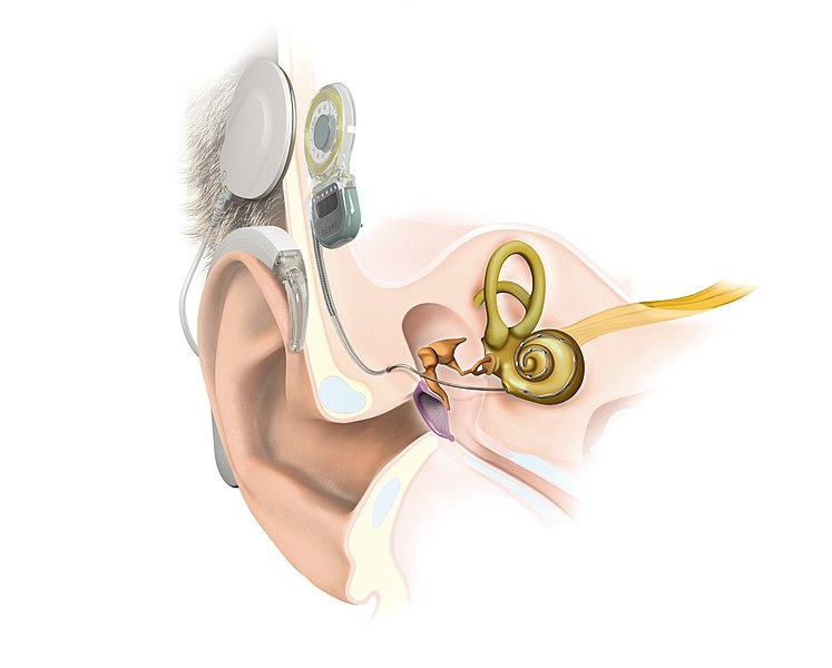 auditioSJA's tweet photo. Call for papers of our Special Collection:
"Advances in Implantable Hearing Devices"
More info
https://t.co/1W8jI2Mzpq
image: Hear hear! https://t.co/Ph8Zx5Zesp