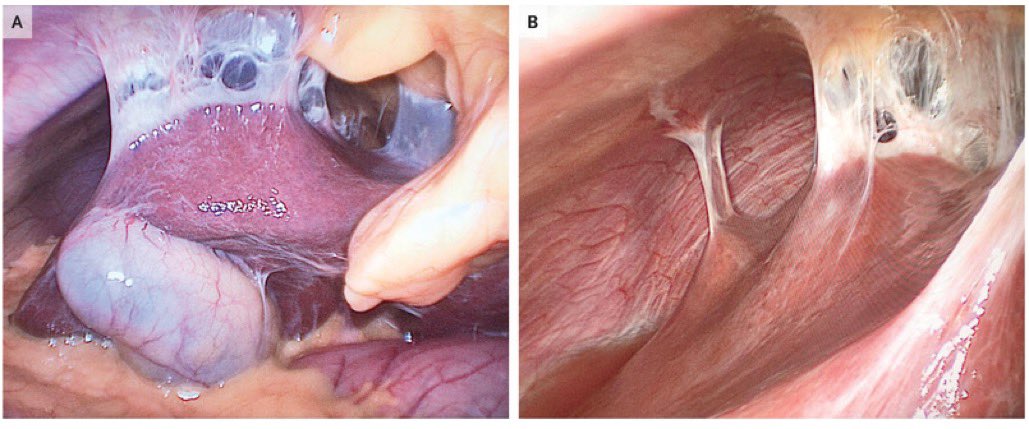 Avraham Z. Cooper, MD 🩺 tweet media