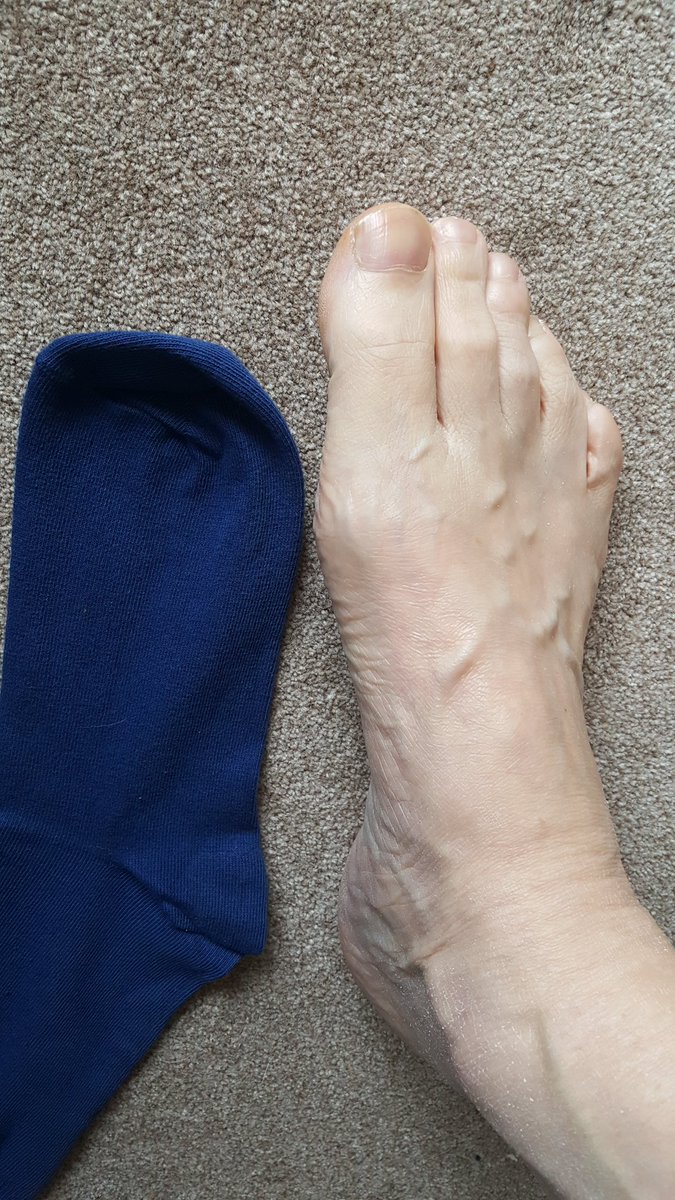 PatrickHoyle3's tweet photo. @marksandspencer my size 11 foot, your size 12 to 14 sock :-( https://t.co/Z4IEzPrMbB
