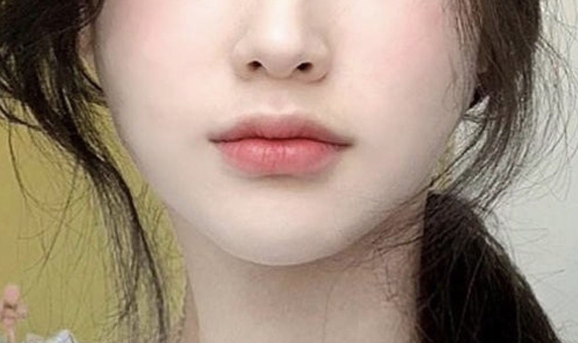 ____rieee's tweet photo. 唇ヒアル･口角ボトックスまとめ🫦♡
ㅤ
2枚目はヒアルロン酸を打った部分で
3枚目は先生に見せた参考写真です🌸 https://t.co/gVrfXC1ad6