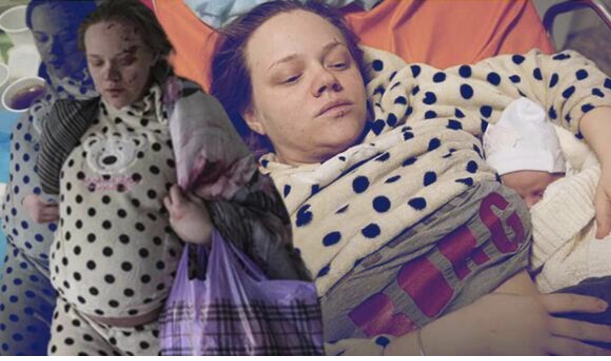 Mariupol’de bomba isabet eden Hastaneden hamile kurtulan sembol kadın Mariana Vishegirskaya doğum yaptıktan sonra Rusya’ya  iltica etti ve çok çarpıcı açıklamalar yaptı:
“Ukraynalı militanlar hastaneyi karargah yapıp hedef haline getirdi. Hastaların yemeklerine bile el koydular.”