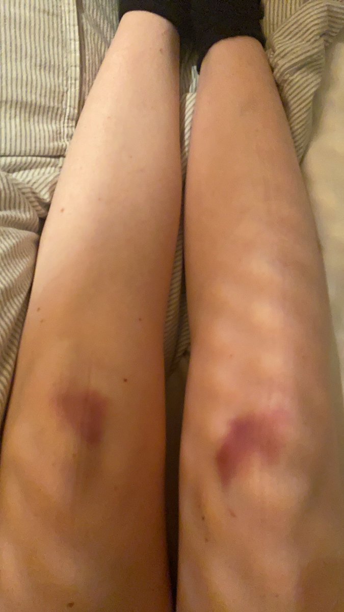 elinrosag's tweet photo. Og þessa kalla ég “fór á æfingu og gerði burpees”. Þetta look verður mjög hot í sumar https://t.co/C87D9unmy2
