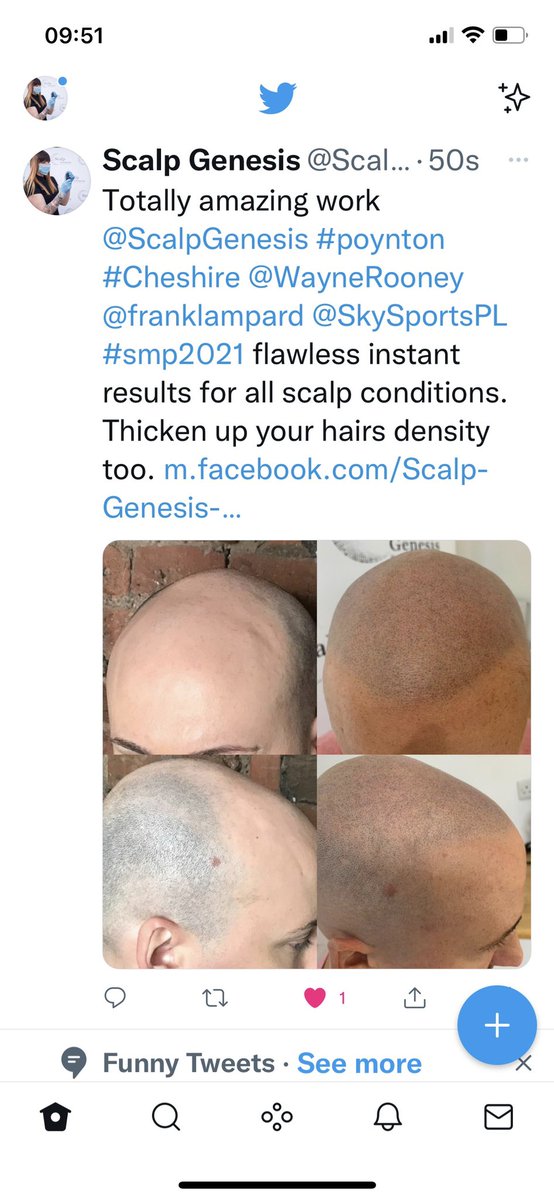 Scalp Genesis tweet media