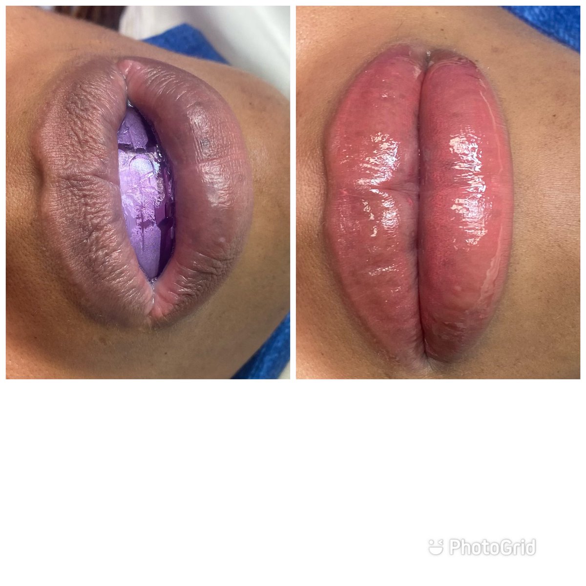 cosmicillnani's tweet photo. Lip Neutralization for my 🌿💨 loves #lipneutralization #darklips #sexylips #poutylips #lightenlips #kissmenow #cosmetictat #whosmokes #WeedLovers
IG BeautifulBeastieLA
https://t.co/HI5JyWrd3C https://t.co/HtAbE2EFyI
