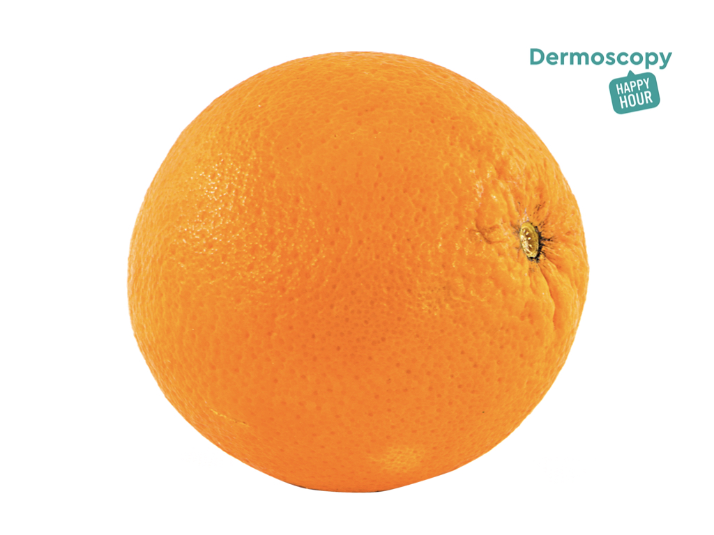 aimlallas's tweet photo. In today's #dermoscopyhappyhour we discuss with @geppiargenziano about one of the most fascinating colors! And of course the #youdermoscopy case of the week by @KLiopyris, forum's best case selected by @akay_bengu and our usual #kahoot challenge! https://t.co/NvEGUQLwEr