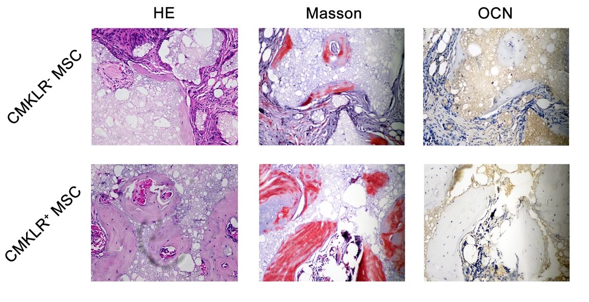 MesenchymalCell's tweet photo. 📍 Researchers at Sun Yat-sen University performed cell mapping of #BMSCs through #scRNA sequencing and identified three functional #subpopulations, providing new insights into the biological features and clinical use of MSCs at the single-cell level.
🔗 https://t.co/EszP8KaiIH https://t.co/yqHkQJ8v8Q