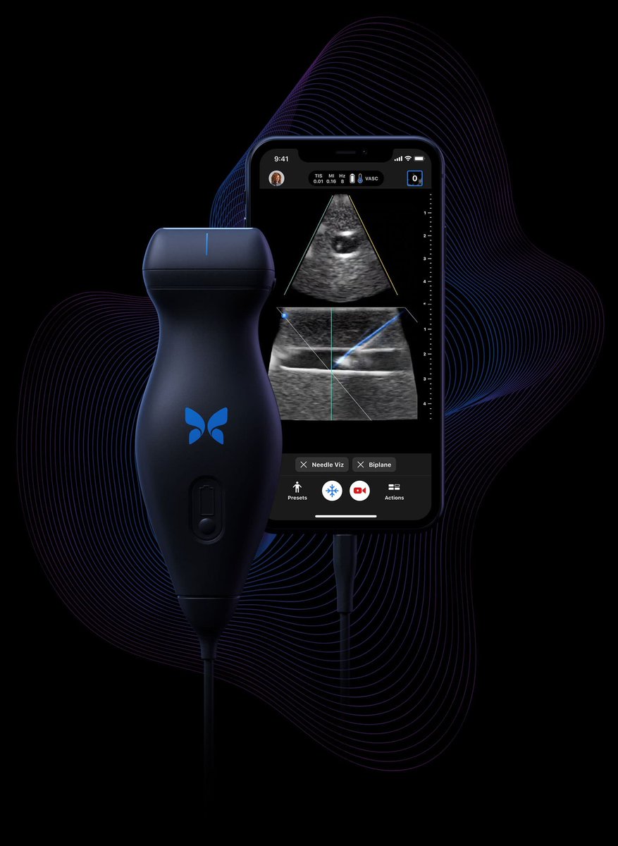 Dx_imaging's tweet photo. #5 Most Read Content in March: Is Handheld #Ultrasound the 'New Stethoscope'? https://t.co/3HtVWTlq79 @POCUS_Society @RSNA @ACRRFS @ACRYPS @futureradres @RadiologyACR @ARRS_Radiology @mpanner @Intelerad #radiology https://t.co/xrgEHZ6HHA