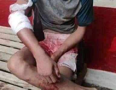 3.4.2022
In Monywa Prison
To the prisoners
There were casualties when the terrorist army opened fire.
#WhatsHappeningInMyanmar