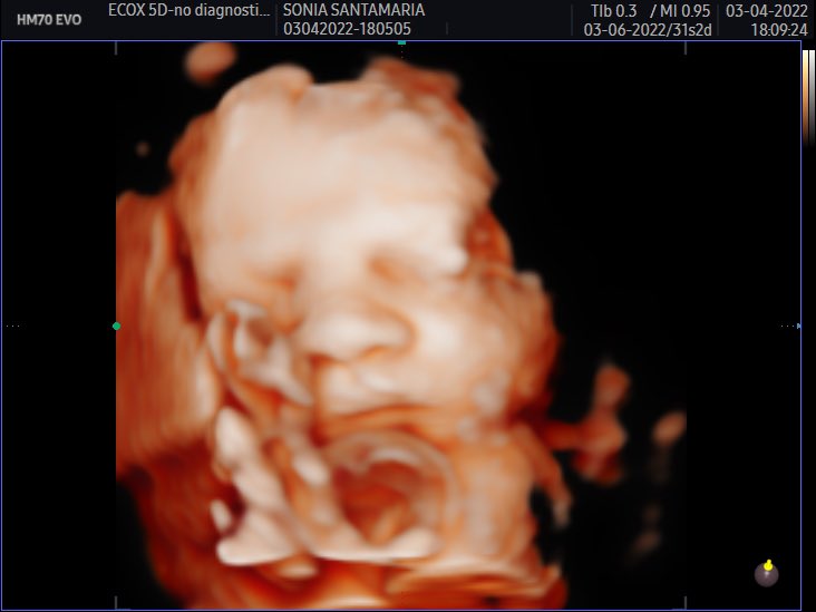 Hola amor de mi vida, papá y yo tenemos muchas ganas de comerte a besos, no tardes mucho en salir ♥️✨ 
 <a href="/Cr0n0s/">Toni Soriano</a>