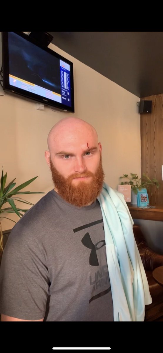 A weekend without much football but we’re back with a third team win (3-2) here’s a picture of our angriest player <a href="/Tyson_Fury/">TYSON FURY</a> . Parkin 2 Huskins 1 Motm Parkin. Shaw -1 JB -2 for being our best player and only playing 7 minutes