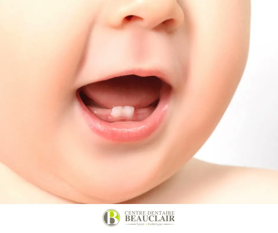 DreBeauclair's tweet photo. La dentition primaire de votre enfant débute et ce dernier semble en souffrir ? Ne vous en faites pas ! Voici ce que vous pouvez faire : 

✅ Frotter les gencives avec votre doigt.
✅ Frotter les gencives avec le dos d’une petite cuillère froide.

📞(819) 378-8888⠀ https://t.co/nOAPoacUm1