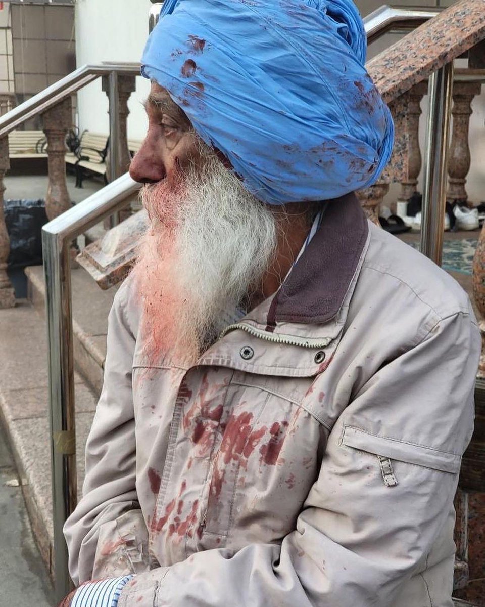 SherePanjabUK's tweet photo. Saddest part was he didn't want to see an ambulance or report it because he is on a visitor visa and he was worried about getting sent back.” - @g_toor (Insta)

Via @gurjitsingh (Insta) “He was attacked on 95th Ave and Lefferts, Richmond Hill, NY on April 3rd Sunday Morning

2/3 https://t.co/6VXqSp6K6O