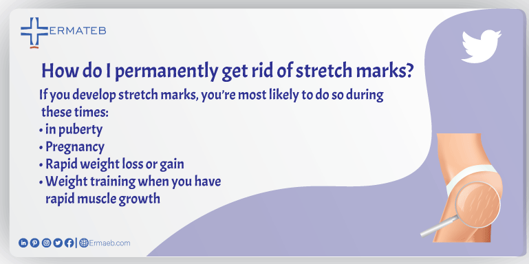 ErmatebEn's tweet photo. ✅ How do i permanently get rid of #stretchmarks ?
🟥If you develop #stretch_marks, you’re most likely to do so during these times:
🔴in #puberty
🟣#Pregnancy
🟡Rapid #weightloss or gain
🟢#Weight training when you have rapid #muscle #Growth.
🟣🟣🟣
https://t.co/K1sCXoJHV6 https://t.co/WzX5IneTo1