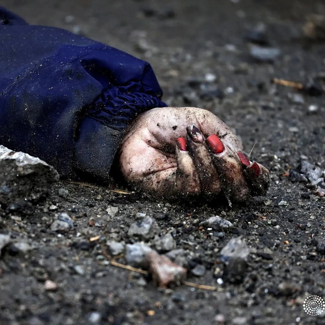 .
لعنت به جنگ .... 
لعنت به دیکتاتورهای تاریخ که تنها راه حل را کشتن انسان‌های بی‌گناه میدانند.
😢💔