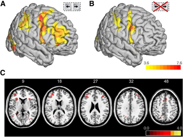 hakwanlau's tweet photo. this figure from Frassle et al 2014 JNeurosci is often taken to sugggest that when report was not required (B), changes in subjective percept was no longer associated with lateral prefrontal activity. but this interpretation seems to neglect what was the control condition. 1/ https://t.co/2YWuIZgkm9