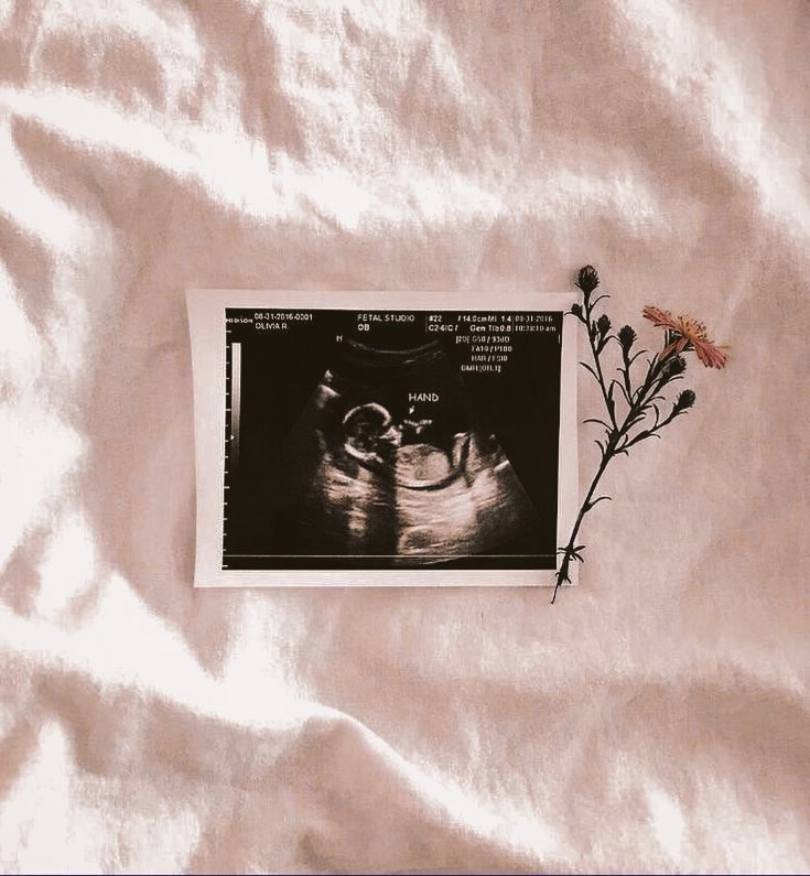 getwaychar's tweet photo. And finally it seems my lonely days are through, i've been waiting for you. i love you, ma vie.♡︎

- @tedsytonks. https://t.co/CPAp9Lty9n