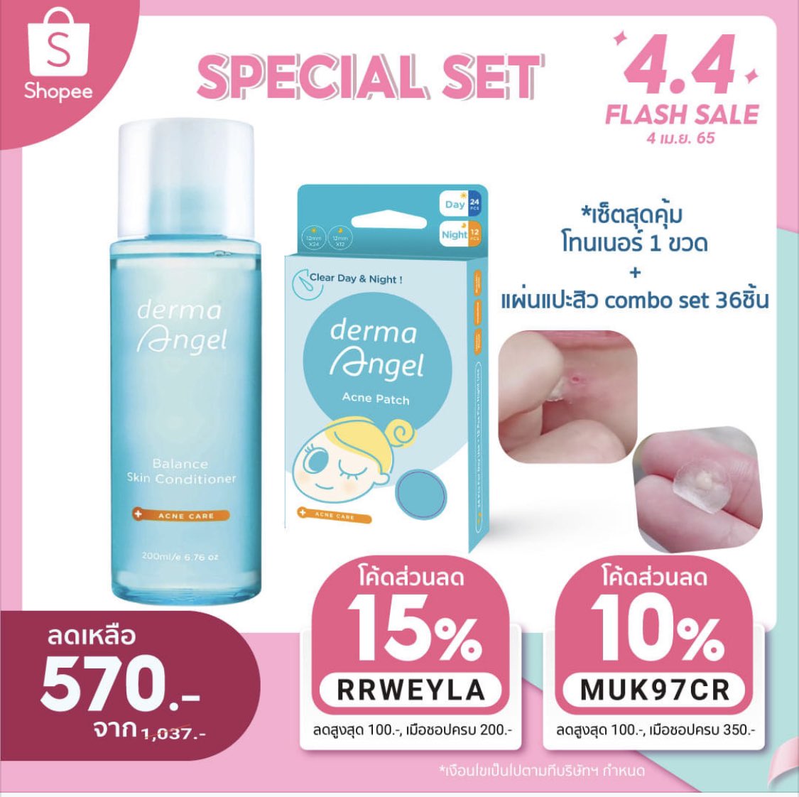 dermaangel's tweet photo. 4.4Flash Sale
ปักหมุดช้อป >> https://t.co/l9wbDh5v64
👉MUK97CR  ลดทันที 10% สูงสุด 100.- เมื่อช้อปครบ 350.- 
👉RRWEYLA  ลดทันที 15% สูงสุด 100.- เมื่อช้อปครบ 200.- 

📅โค้ดใช้ได้วันที่ 4 เมษายน 2565 #แผ่นแปะสิว #โทนเนอร์ #โทนเนอร์ลดสิว #โหนกระแส #ไบร์ทวิน #ไบร์ทตู #จิมมี่ซี https://t.co/DR6LHoRQ57