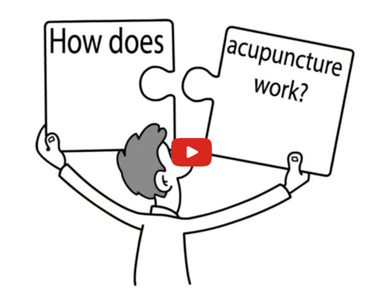 acupuncturecbd's tweet photo. How Acupuncture Works: This video describes how acupuncture works to heal the body in a simple and easy way that anybody can understand. #acupuncture https://t.co/vsUEgq6i8e https://t.co/VaS7LkNMXV