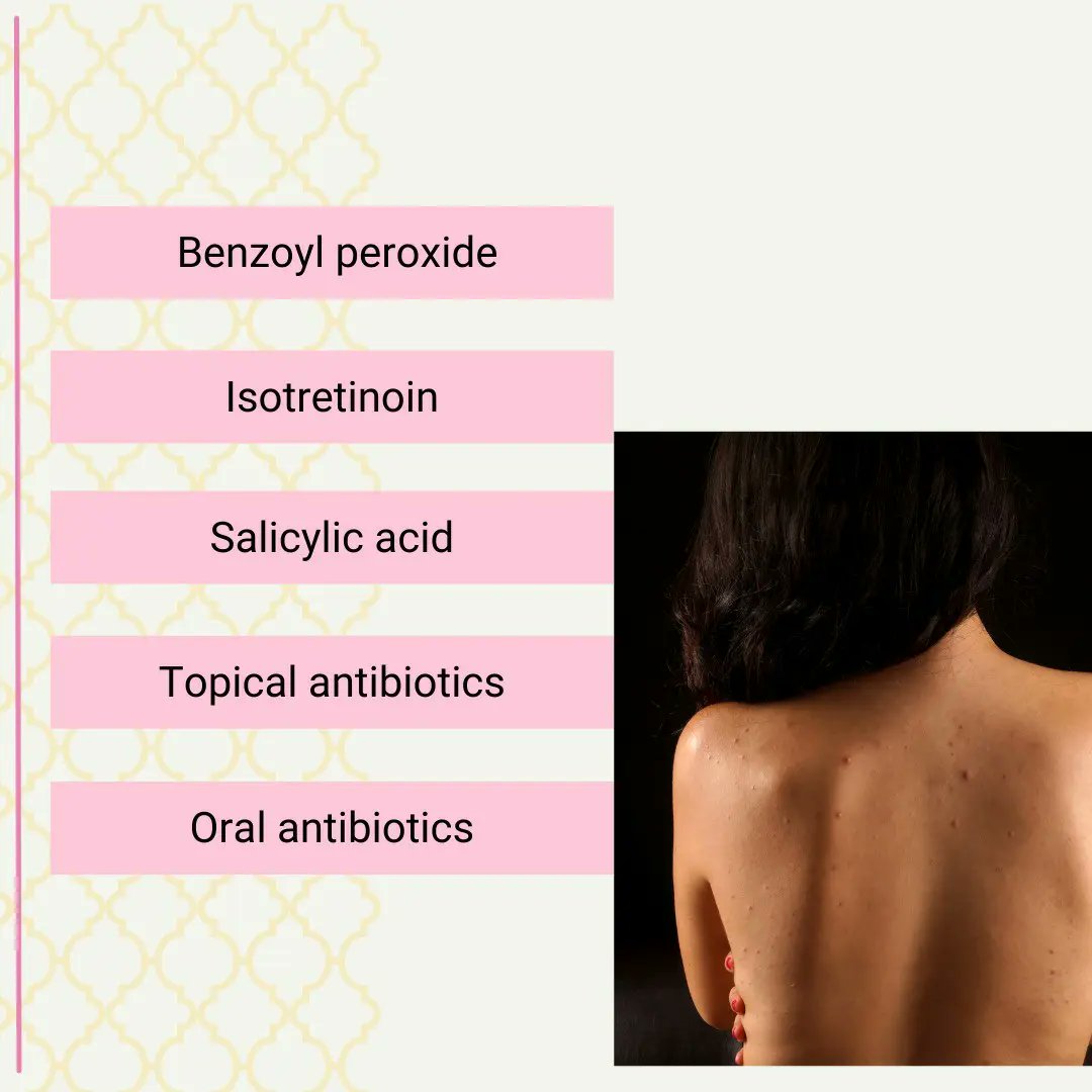 DrShrutikakar's tweet photo. Back Acne Treatment by Dr Shruti Kakar
Back acne is more common than you think and affects in general.
📧 shrutikakar1@gmail.com
📍 Specialist Dermatologist Medcare Al Barsha ,Dubai
#dermatology #cosmetics #backacne #doctor #dubai #india #tips #tricks #skincare #skin #health https://t.co/nxzO9GT3ma