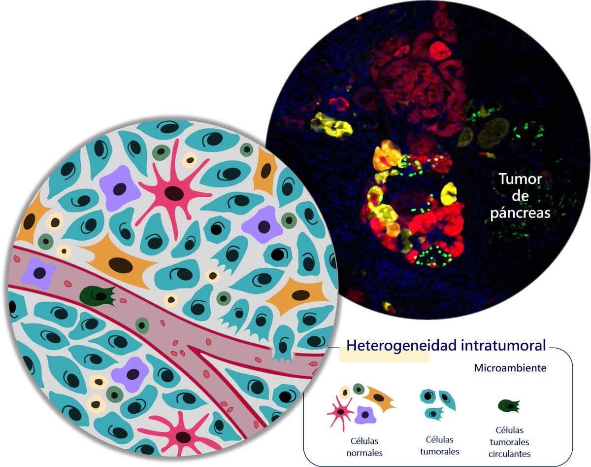 UCDivulga's tweet photo. 🗣️2 #PhDenlaUC | Laura Quevedo: Cada tumor está formado por células muy distintas entre sí. En mi tesis, combino proteínas fluorescentes y otras herramientas para estudiar esta heterogeneidad y poder mejorar los tratamientos de los pacientes con cáncer 👇
https://t.co/icirprA9hb https://t.co/ufKo9gj2Ja