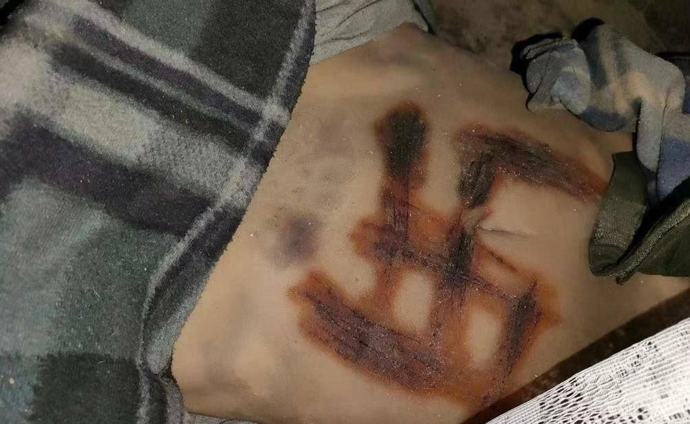 KyivPost's tweet photo. "This is a dead #Ukrainian girl tortured by Russian occupiers to death," Arestovych reported https://t.co/VTQdmURu1O