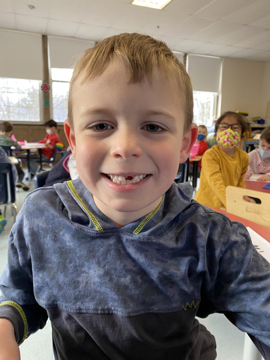 “My dad helped me get my tooth out, and now this is my favorite smile!”