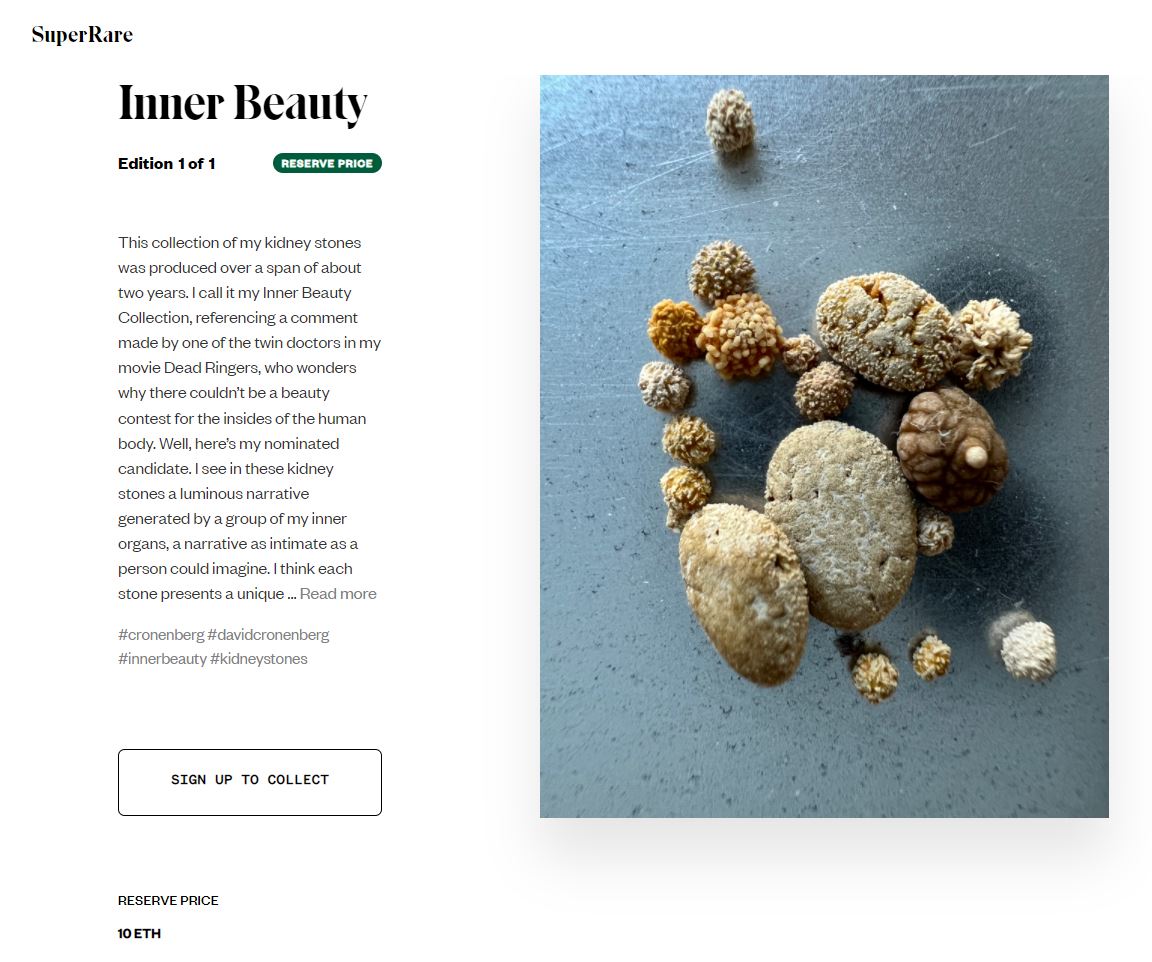 NFT_Executive's tweet photo. Me: Haven't been on SR for weeks...

@SuperRare: $35,000 for a picture of someone's kidney stones.

*logs off* https://t.co/BpZE5Bar0a
